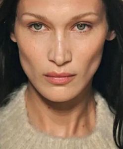 Bella Hadid miała operację plastyczną jako 14-latka. Nie za wcześnie?