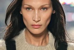 Bella Hadid miała operację plastyczną jako 14-latka. Nie za wcześnie?