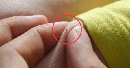 Ludzie myślą, że to pieprzyki. Uważaj, gdy zobaczysz na ciele