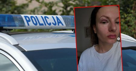 Zsiadł z roweru i pięścią uderzył kobietę. Brutalny atak w Warszawie