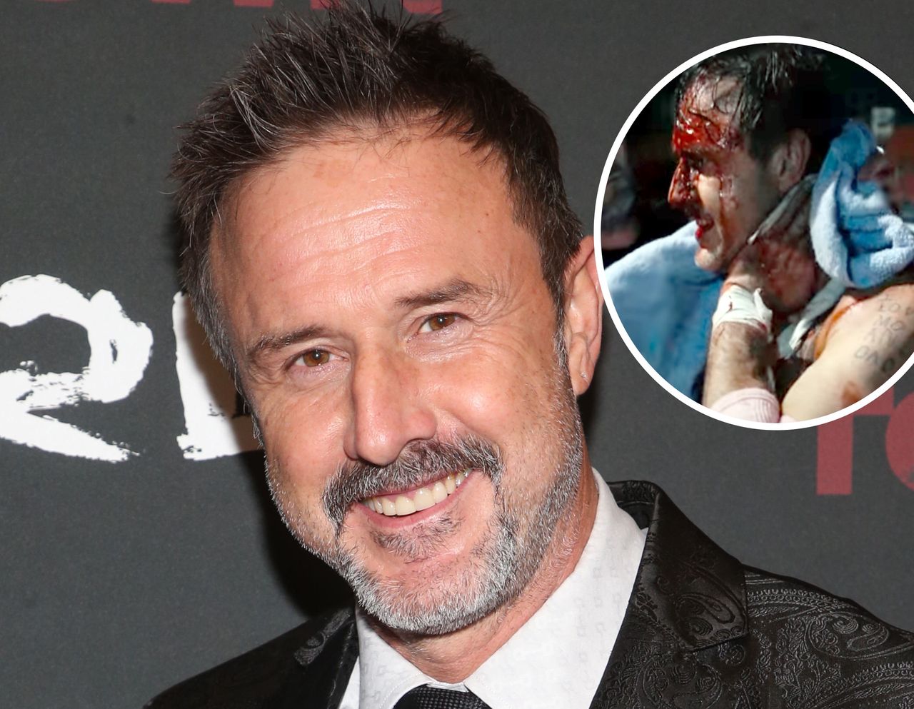 David Arquette dwa lata temu odniósł na ringu poważne obrażenia