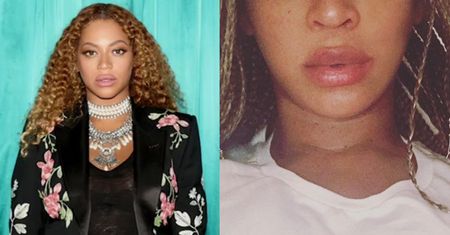 Beyonce tłumaczy się z ogromnych ust! "To przez hormony. Każda kobieta puchnie!"