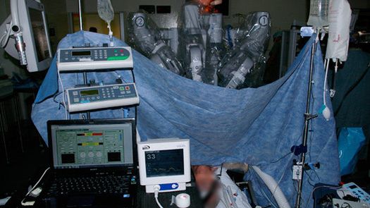 Dałbyś się pociąć robotowi? 1