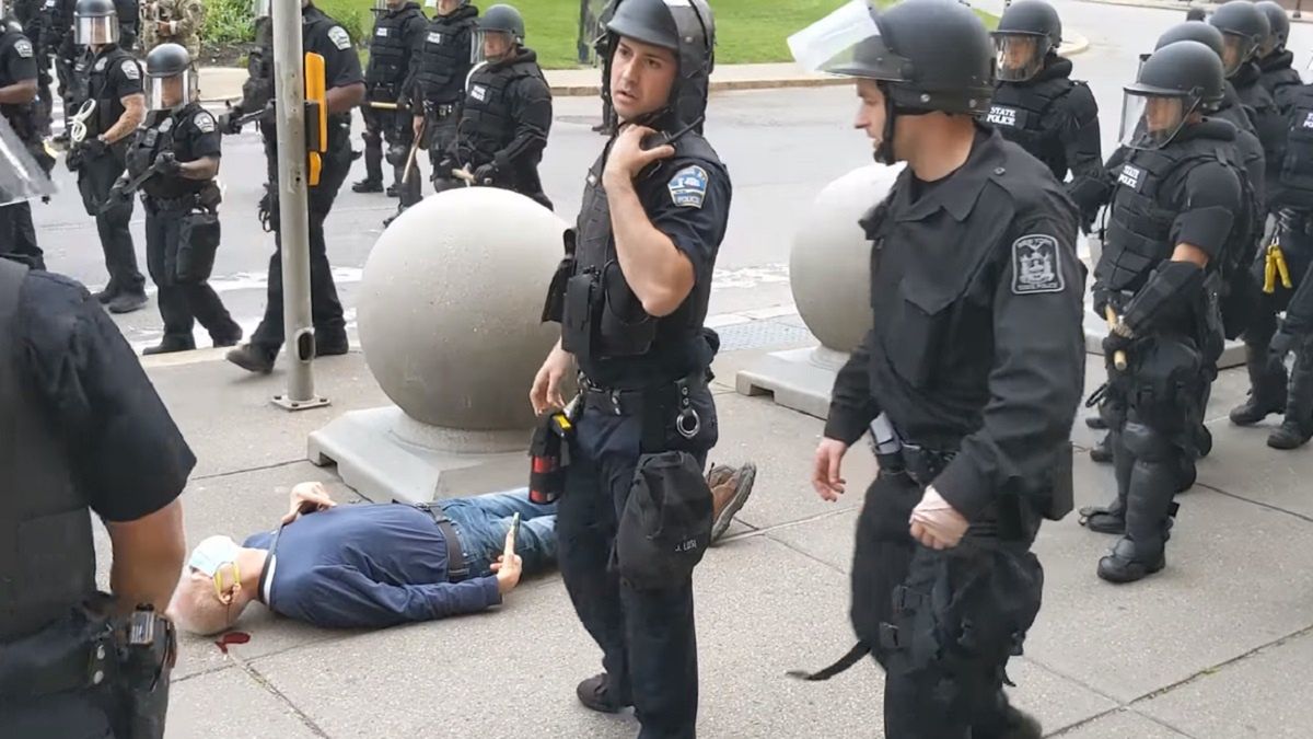 75-latek zaatakowany przez policjantów doznał poważnego urazu mózgu. 