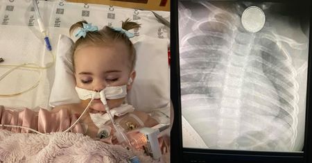 Dziewczynka zmarła po tym, jak połknęła baterię guzikową. Teraz jej mama walczy o bezpieczeństwo innych dzieci