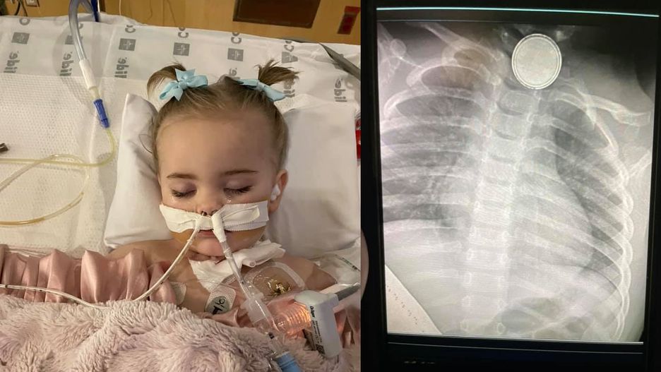 Reese połknęła baterię