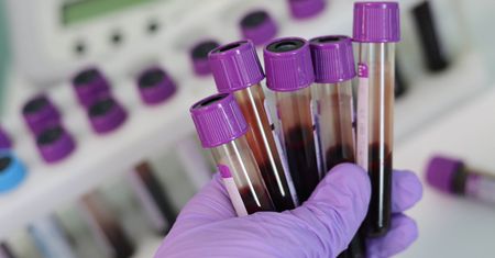 Epidemia szaleje na Madagaskarze. Gorsza niż koronawirus?