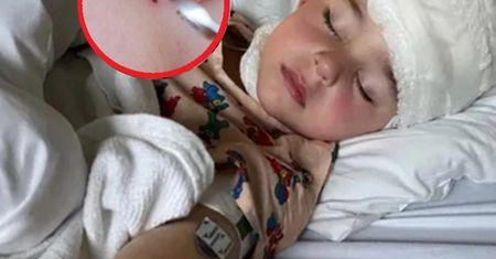 Odkryła "czarną kropkę" na ciele 3-latka. Jego stan zaczął się pogarszać