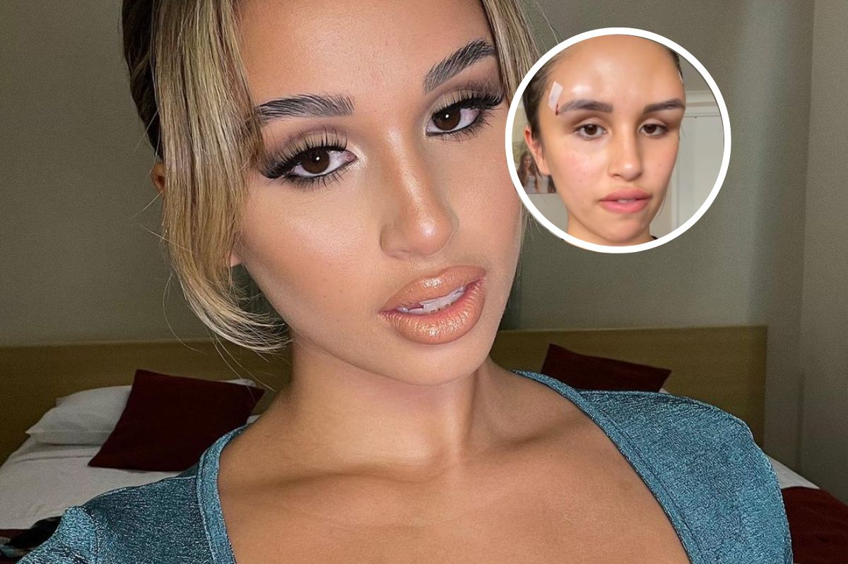 Influencerka Jessie Carr zdecydowała się na lifting oczu