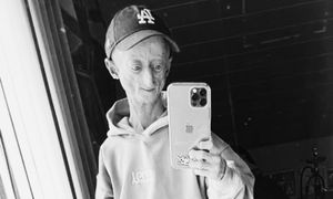 Nie żyje Michiel Vandeweert. Cierpiał na progerię. Dawali mu 12 lat życia