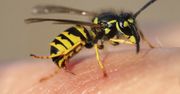 Użądlenie pszczoły lub osy. Sprawdź, jak je rozróżnić i co robić