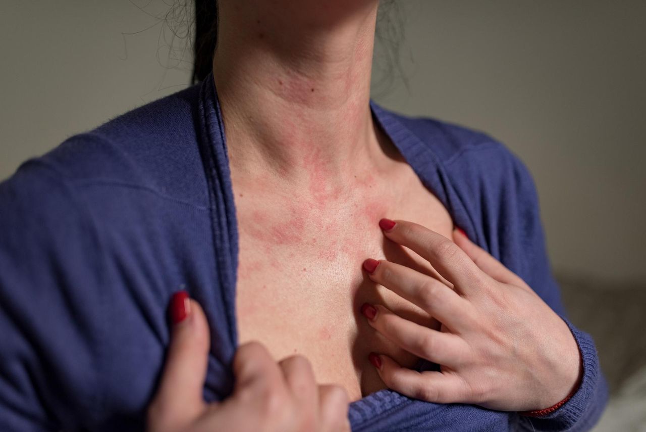 Cierpi co piąty Polak. Problem zwiększa ryzyko raka piersi i tarczycy