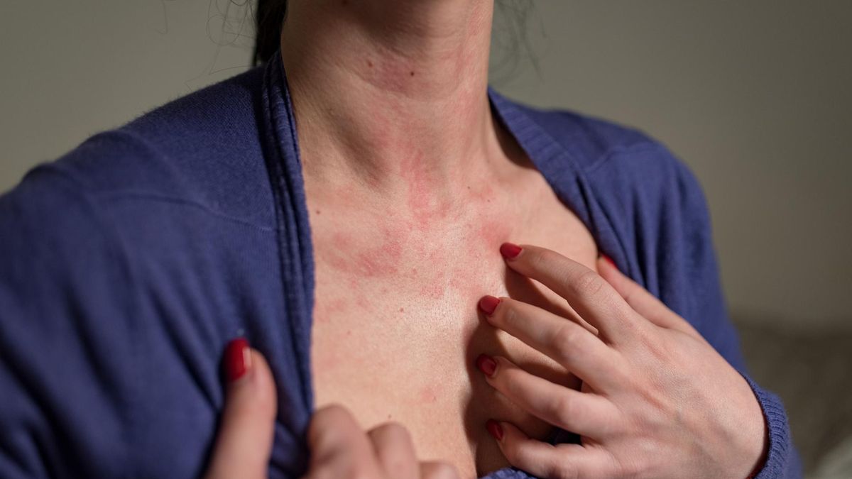 Niektóre choroby tarczycy zwiększają prawdopodobieństwo rozwoju raka piersi. "Ryzyko wzrasta 32-krotnie"