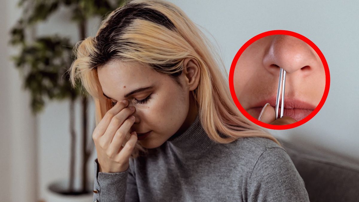 Wyrywasz włosy pęsetą?