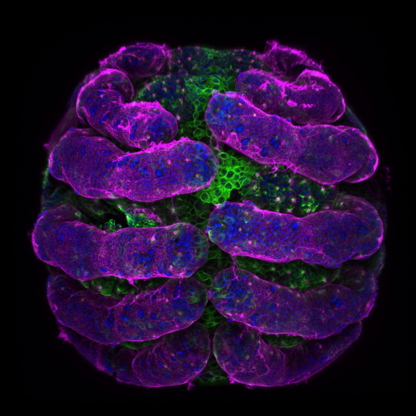 Niesamowity świat widziany z bardzo bliska - Nikon Small World 2018 5