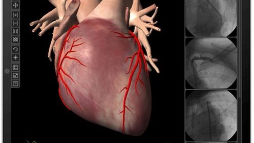Amerykański szpital zamówił 100 iPadów 1