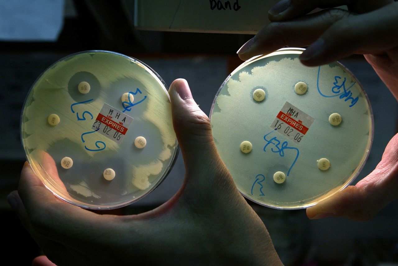 "Żywy czujnik" wykryje mikroplastik. Wystarczyły dwa geny