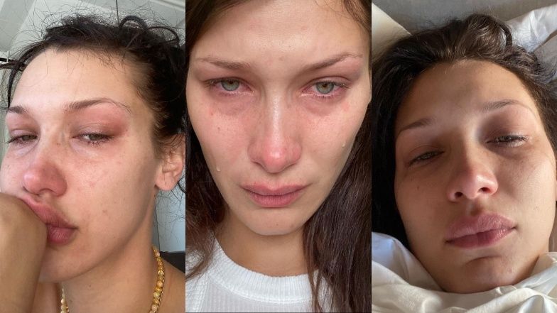 Bella Hadid o zdrowiu psychicznym