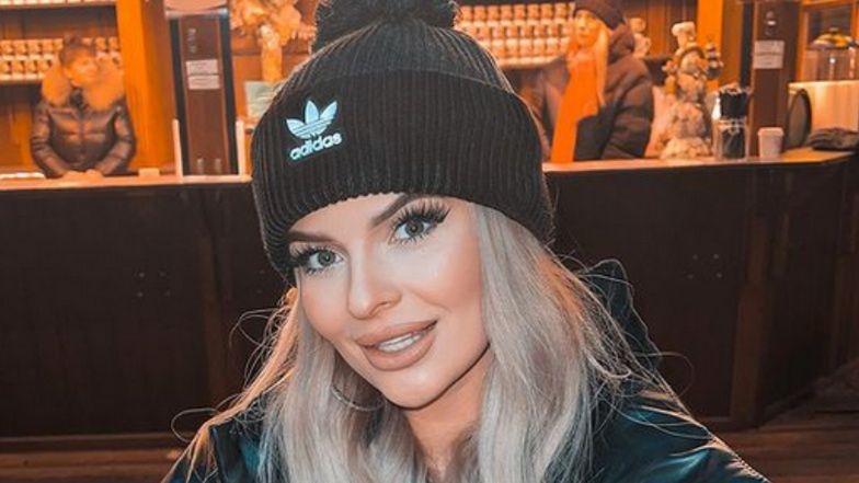 Uczestniczka "Hotelu Paradise" pokazała powiększone usta