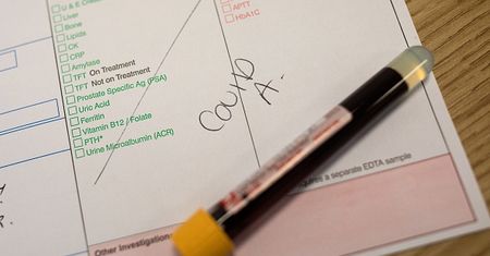 Ekspresowo i tanio wykryją koronawirusa. Nowe testy na COVID-19
