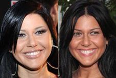 Co się stało z ustami Węgrowskiej?