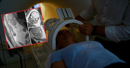 Przerażające zdjęcia z badania. Lekarze twierdzą, że są autentyczne