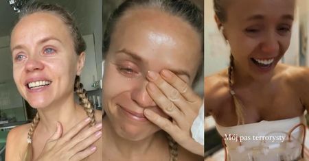 Zapłakana Anna Skura relacjonuje ze szpitala: "Przeszłam POWAŻNĄ OPERACJĘ. Nie będę wyglądać tak samo" (ZDJĘCIA)