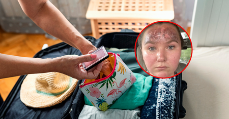Nie sprawdziła daty ważności kosmetyku. Fatalne skutki