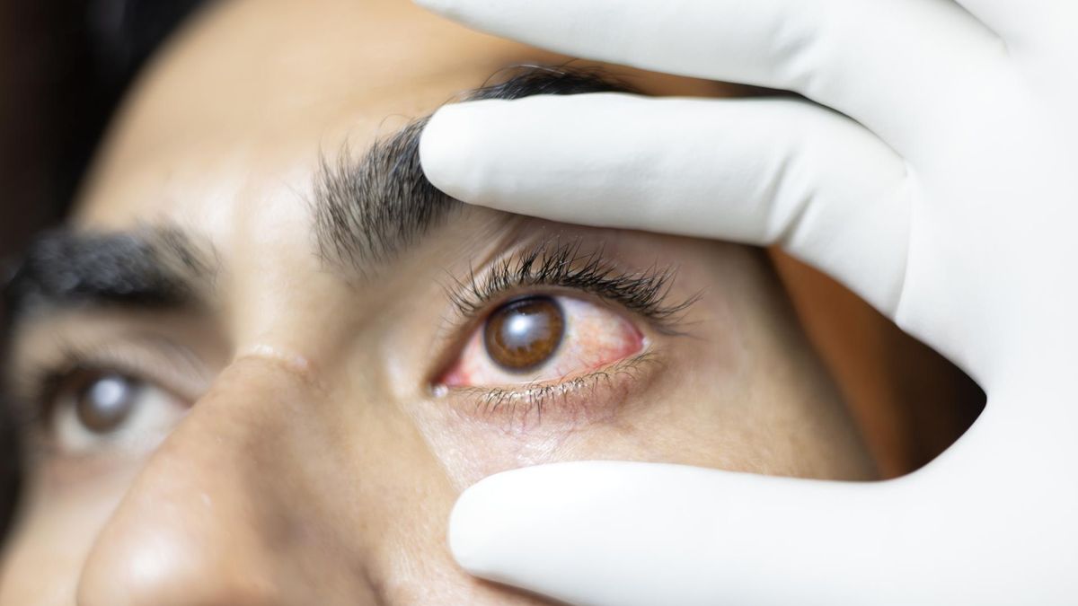 Nawet 13 tys. przypadków w jeden dzień. Azja walczy z epidemią "różowego oka"