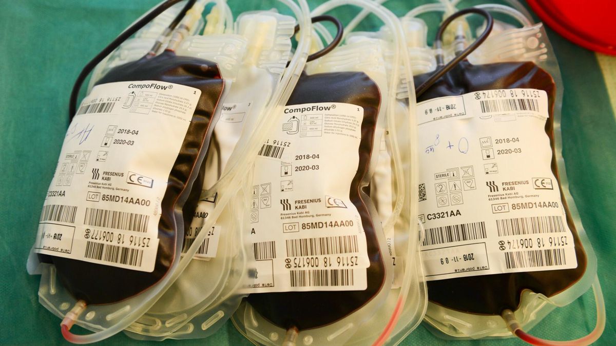 Znacząca liczba chorych na koronawirusa ma problemy z nerkami