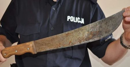 23 ciosy maczetą. Chirurdzy musieli przyszyć 32-latkowi część twarzy