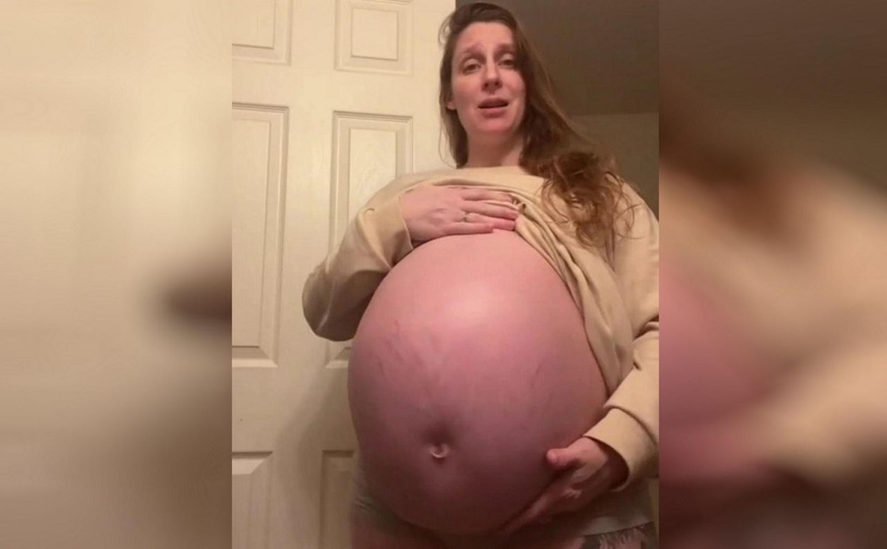 Pokazała ogromny brzuch. Jego wygląd zaniepokoił lekarza