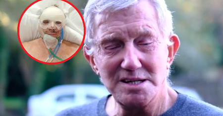 Operacja plastyczna skończyła się tragicznie. 80-latek gorzko żałuje swojej decyzji