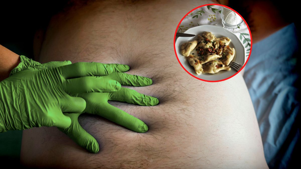 Badacze odkryli, które produkty mogą powodować raka żołądka