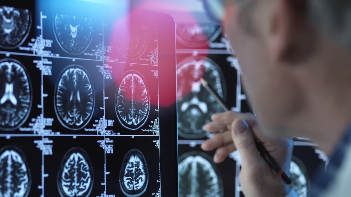 Doctor viewing brain scans for possible disease or damage in clinic
Andrew Brookes
55 to 59 years, advancement, brain scan, cell, clinic, diagnosis, disorder, health, healthcare, male, neurology, pharmaceutical research, result, screen, view