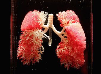 sztuczne płuca