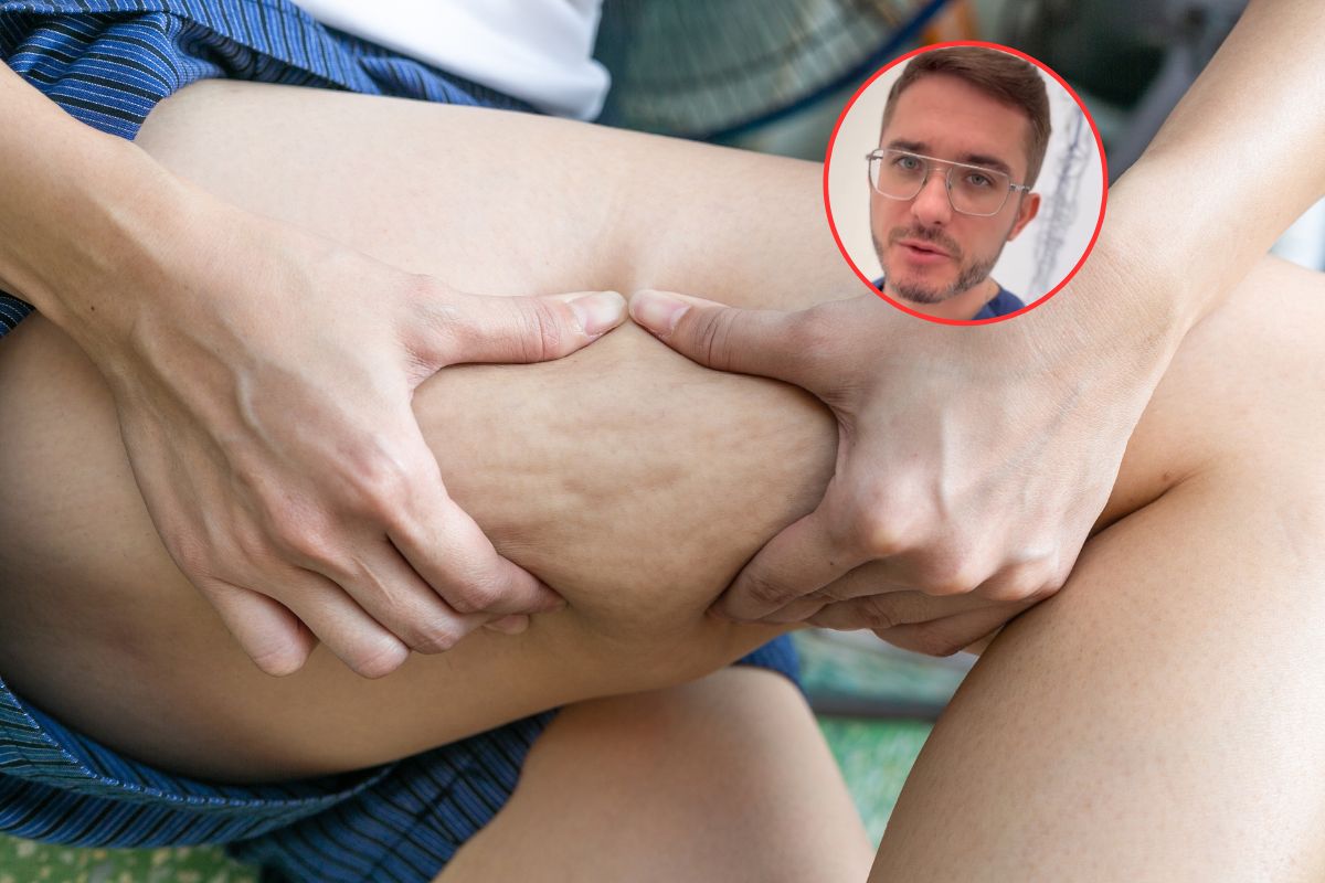 Flebolog ostrzega kobiety. "Powoduje cellulit, zmienia wygląd nóg"