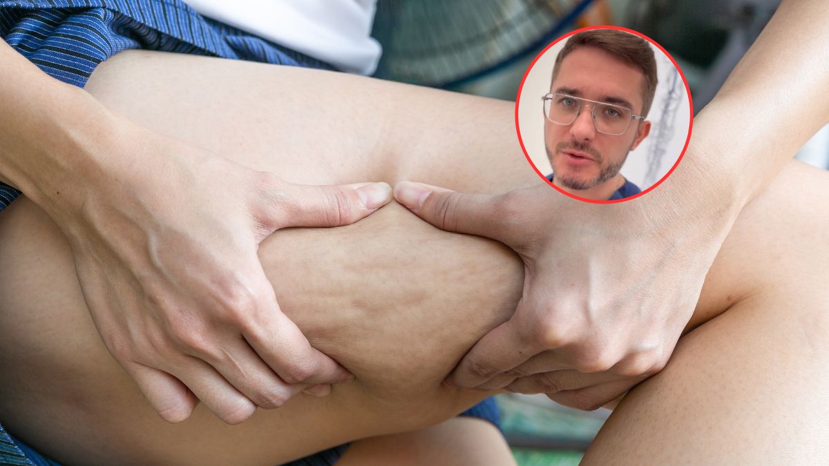 Zła dieta, brak nawodnienia i ruchu mogą nasilać cellulit