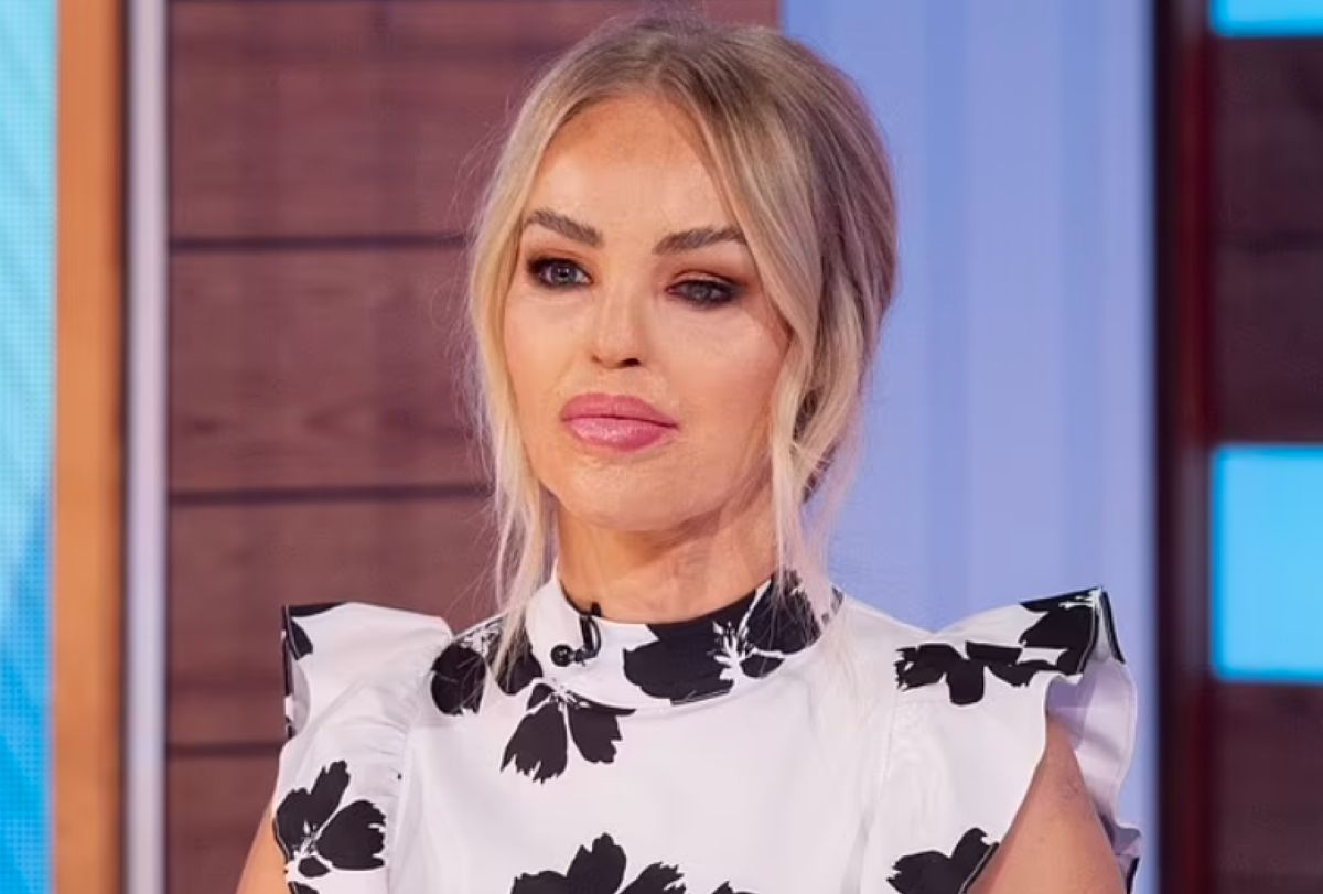 Katie Piper jest m.in. prezenterką w brytyjskiej telewizji