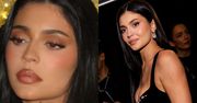 Kylie Jenner rozpuściła usta? "Wyglądają NORMALNIE" (FOTO)