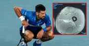 Djokovic krytykuje "ekspertów" od kontuzji. Udostępnił zdjęcie MRI