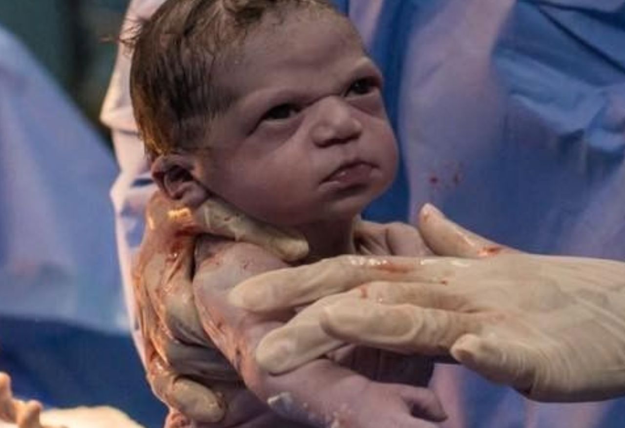 From an "angry" newborn to a blossoming child. What does she look like now?