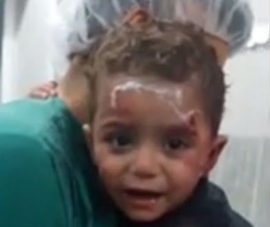 Agonia syryjskich dzieci na poruszającym wideo. Zakrwawiony chłopczyk przytula się do lekarza i nie chce go puścić