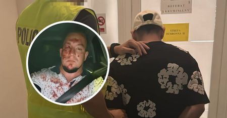 Słupski taksówkarz uderzony butelką w twarz. 35-letni obywatel Kolumbii zatrzymany przez policję