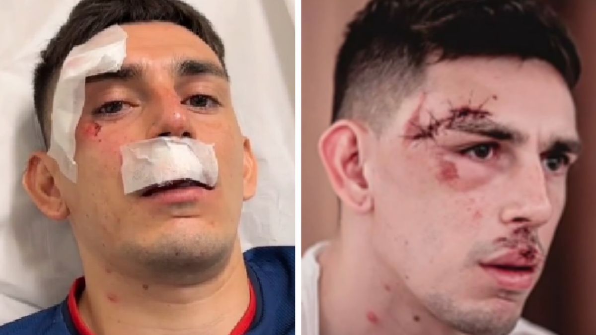 Na zdjęciu: Gonzalo Escobar