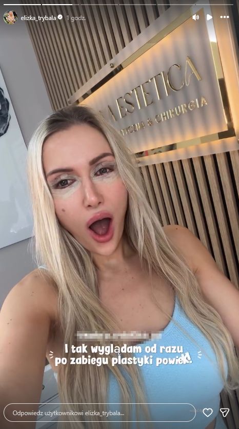 Eliza Trybała zafundowała sobie plastykę powiek