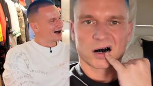 TYLKO U NAS: Bart Pniewski zrobił sobie czarne zęby. "Taki grillz może kosztować 1 mln zł"