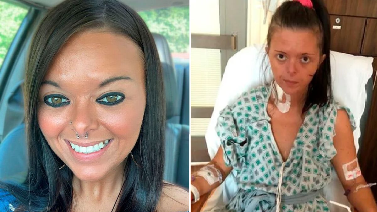 Przez palenie e-papierosów Amanda trafiła do szpitala 