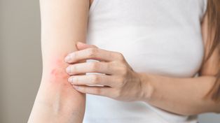 Nietypowy objaw. Może sygnalizować raka trzustki