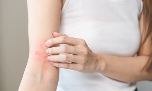 Nietypowy objaw. Może sygnalizować raka trzustki